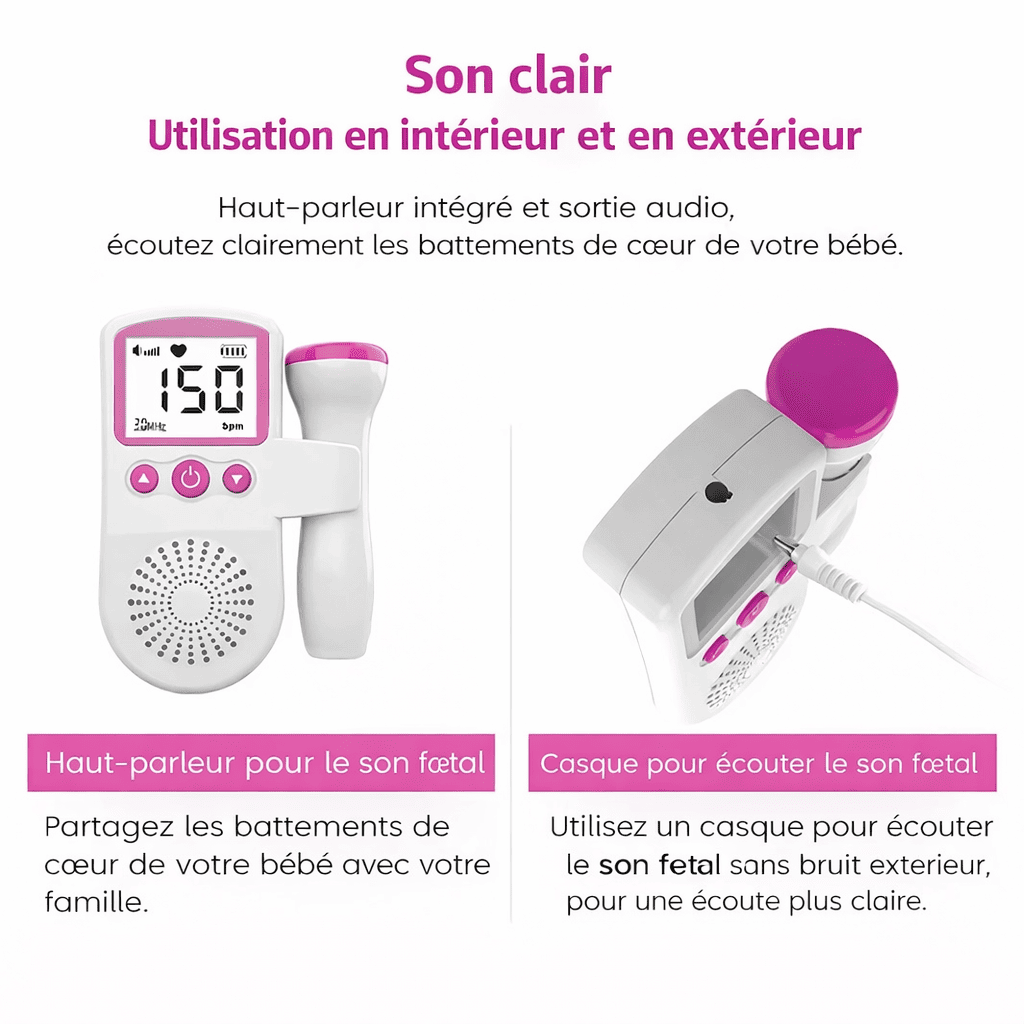 Doppler Fœtal